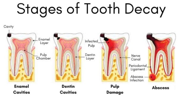 holistic dentist seattle, biological dentist seattle wa