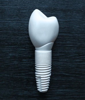 ceramic dental implant, zirconia dental implant, non metal dental implant