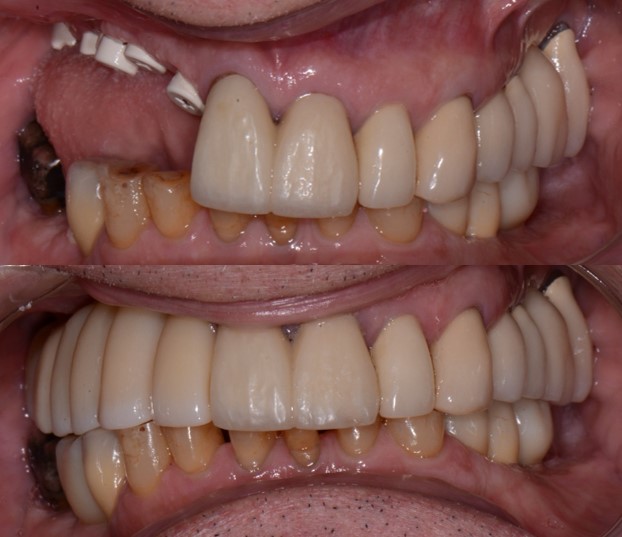 Seattle Dental Care Seattle Dental Care