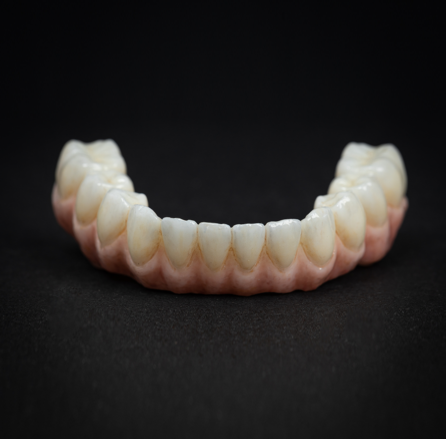 Ceramic Implants