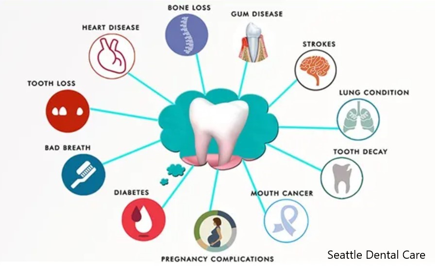 tooth meridian tooth organ chart, naturalpathic dentist, meridian chart