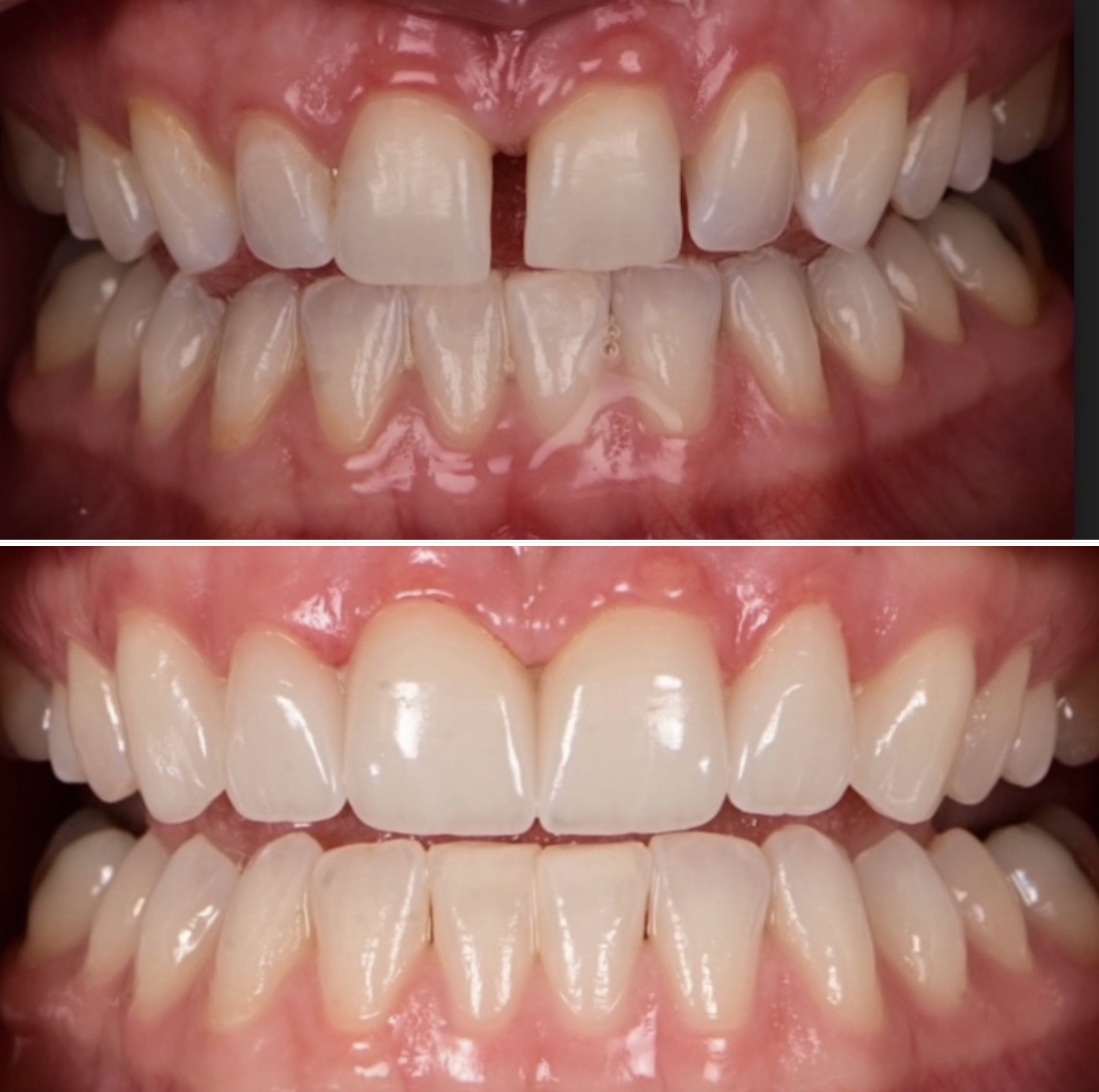 Seattle Dental Care Seattle Dental Care