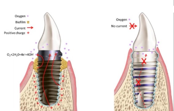Seattle Dental Care Seattle Dental Care
