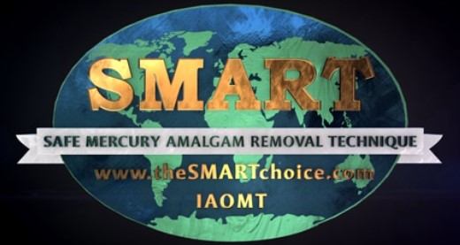 SMART, safe mercury filling removal, amalgam removal